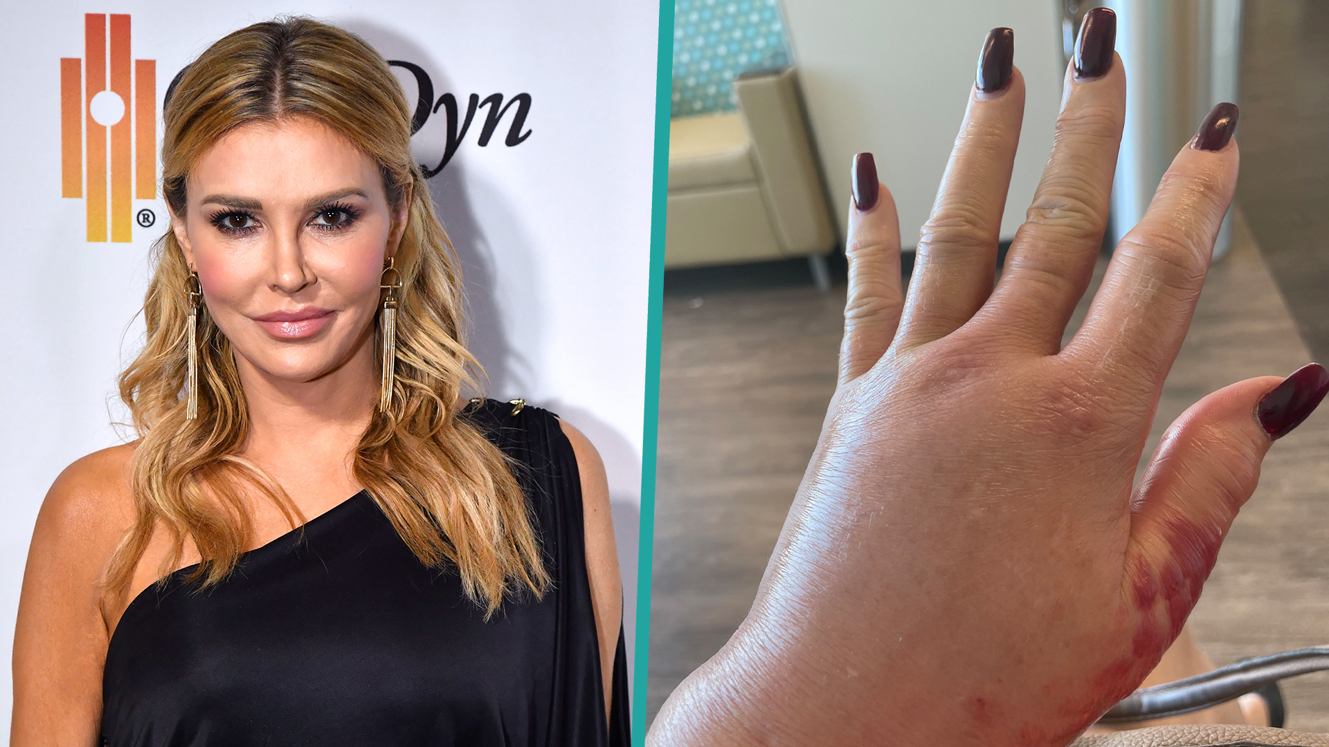 RHOBH Alum Brandi Glanville Hospitalized After Spider Bite I Could(02)