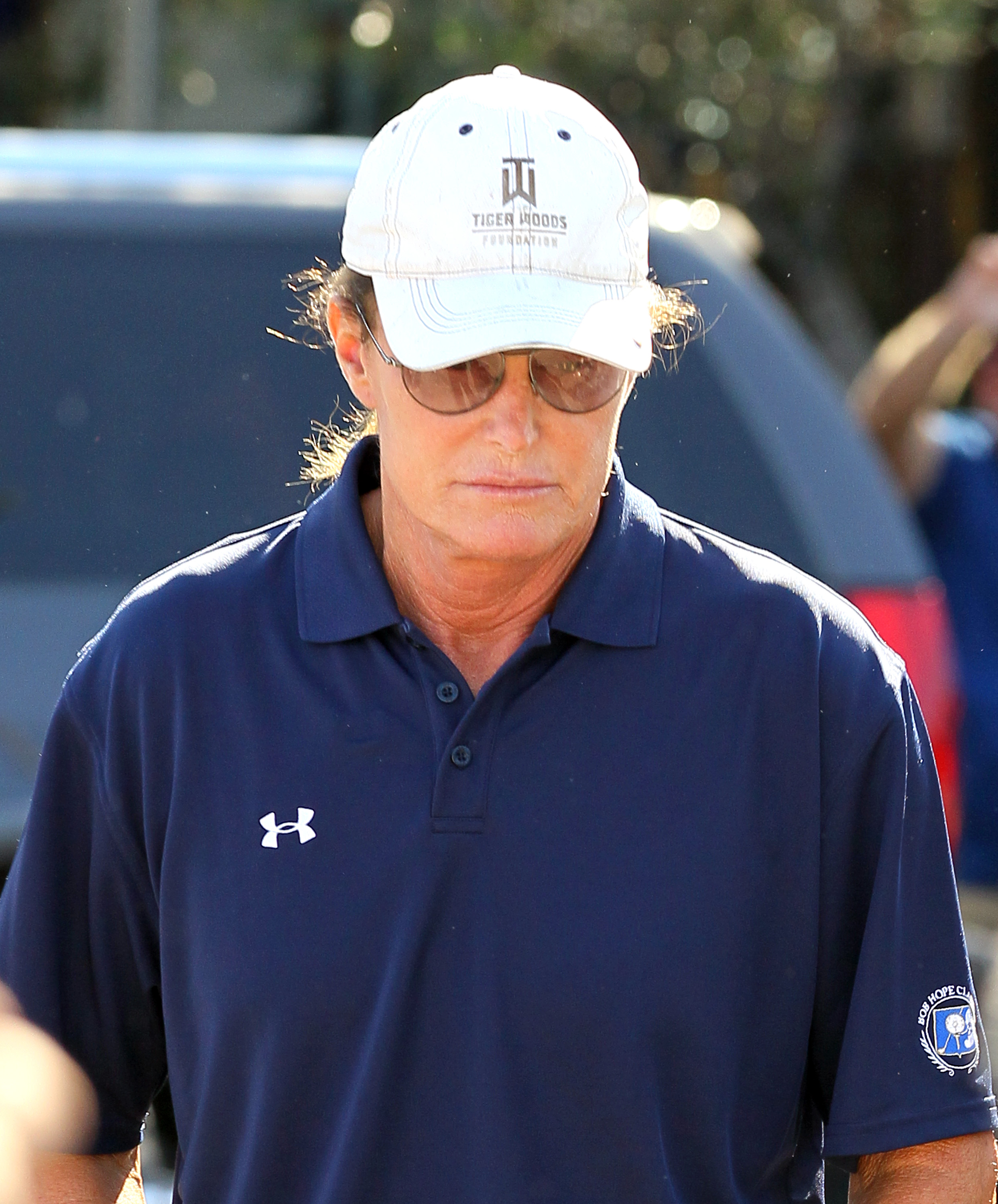 Bruce Jenner Did NOT Have Gender Reassignment Surgery - Access
